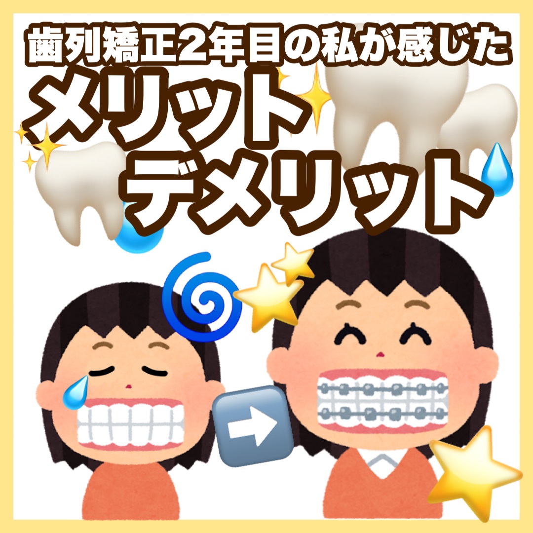 お久しぶりです🍀

今回は現在進行形で私がしている歯列矯正についてお話します！

------------------------------------------------

私の矯正前の歯の状態は、
出っ歯(下と上の歯の隙間が8ミ
