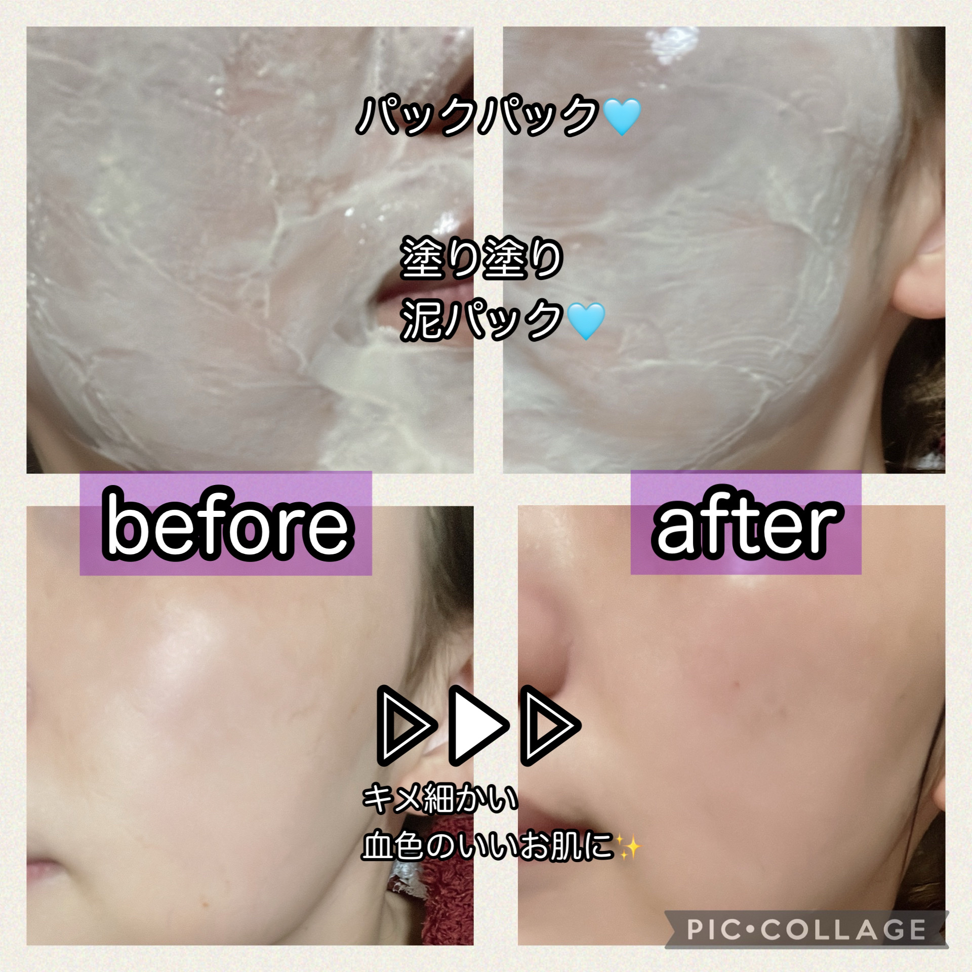 クレンジングバーム/otaf:/クレンジングバームを使ったクチコミ（2枚目）