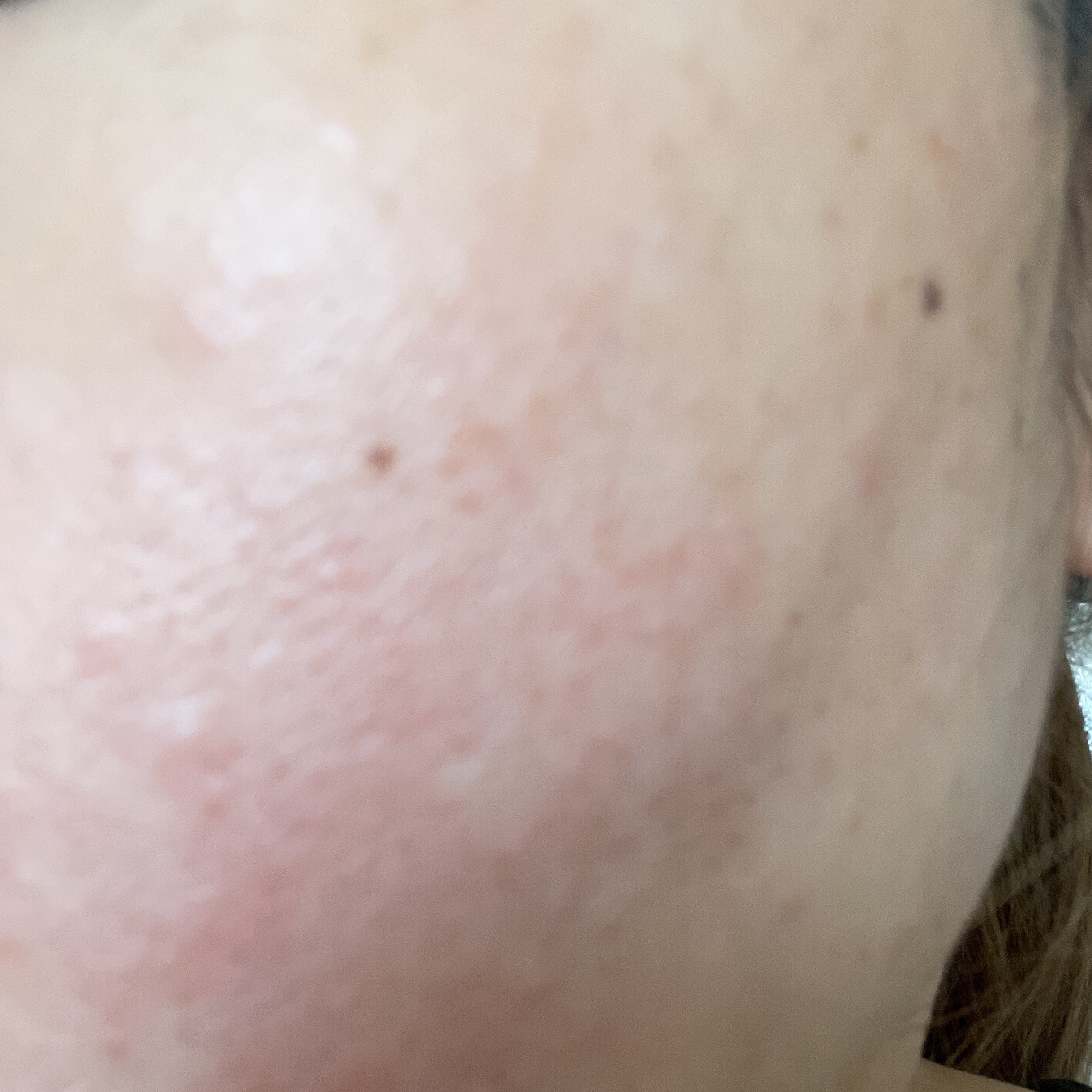 リポピールセラム/LIPOPEEL/美容液を使ったクチコミ（1枚目）