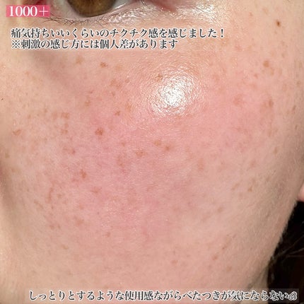 PDRNショット 1000+/fractionalCC/美容液を使ったクチコミ(4枚目)
