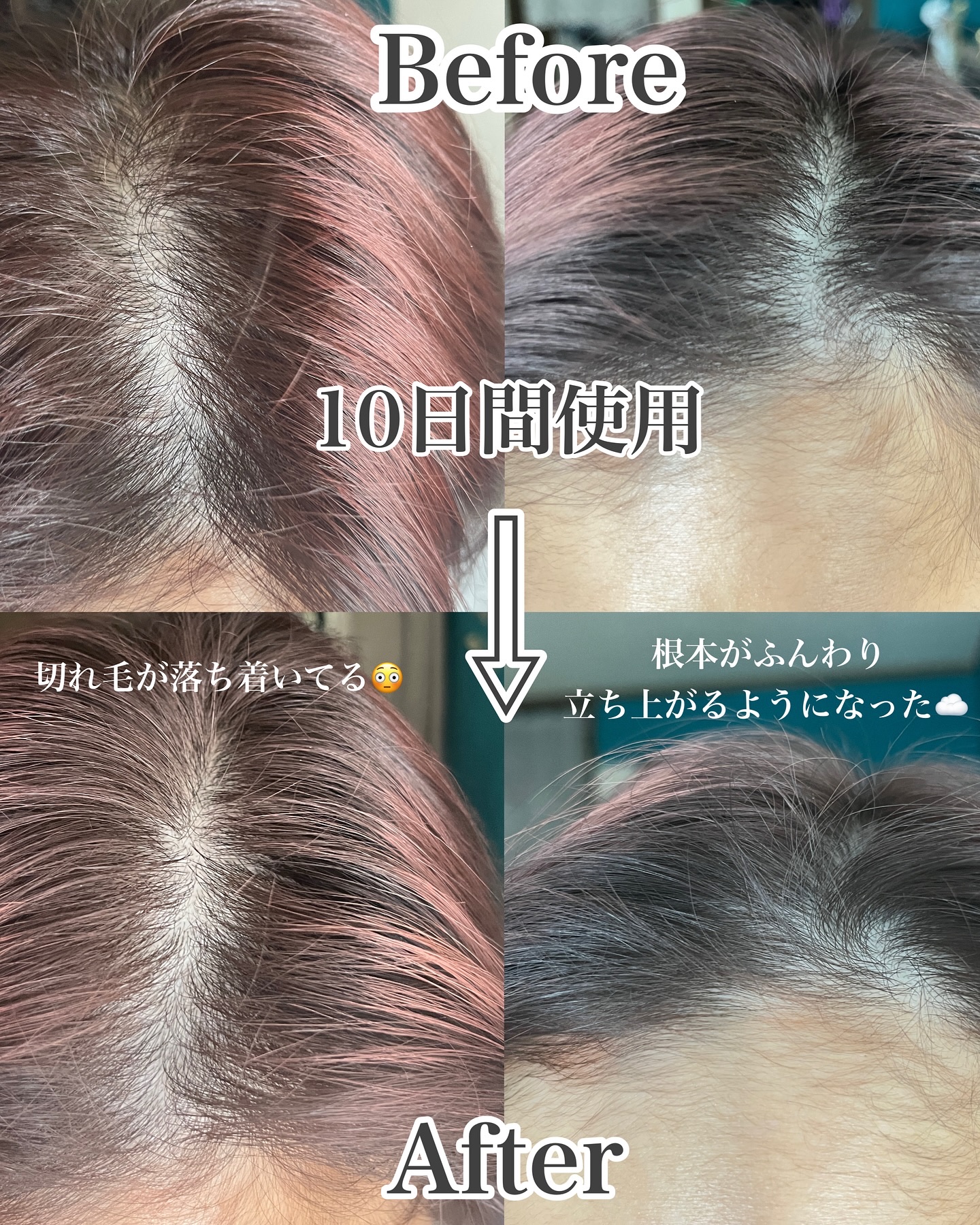 グローターン 100ml/リリーイブ/頭皮ローションを使ったクチコミ（2枚目）