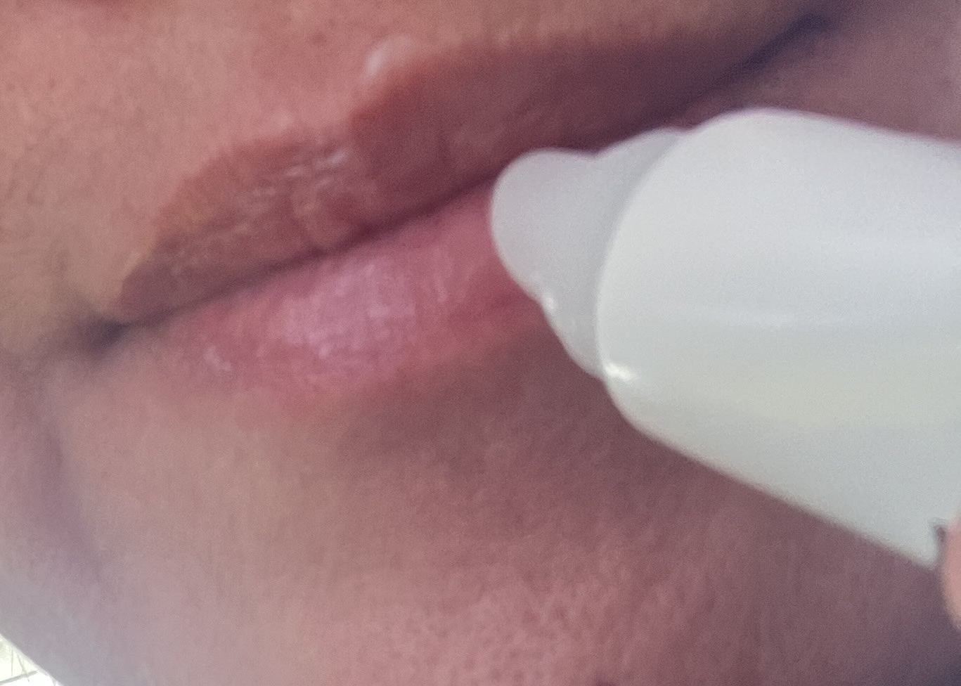 デイニードルリップ/CHOOSY/リップ美容液を使ったクチコミ（3枚目）