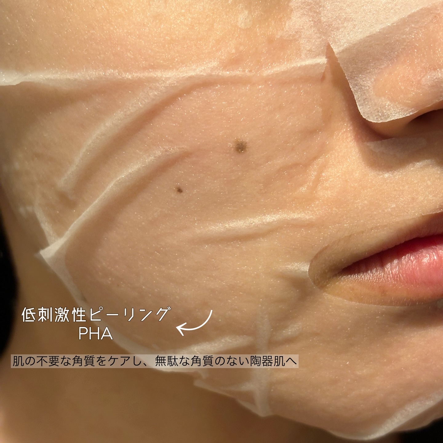 レッドブレミッシュクイックPHAシートマスク/Dr.G/シートマスク・パックを使ったクチコミ（3枚目）