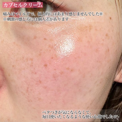 PDRNショット 1000+/fractionalCC/美容液を使ったクチコミ(7枚目)