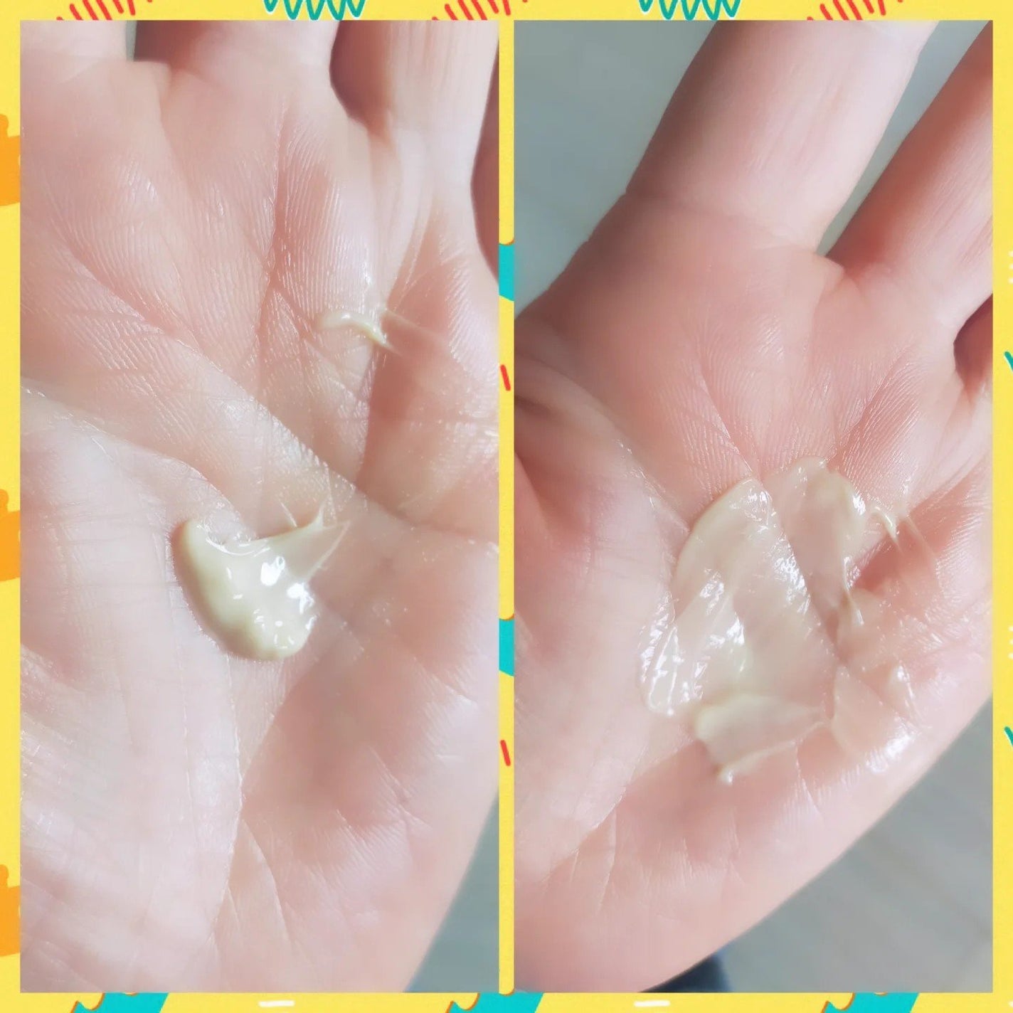 セメンリトカルシウムアンプル+セメンリトカルシウムクリーム/Dr.Melaxin/スキンケアキットを使ったクチコミ(3枚目)