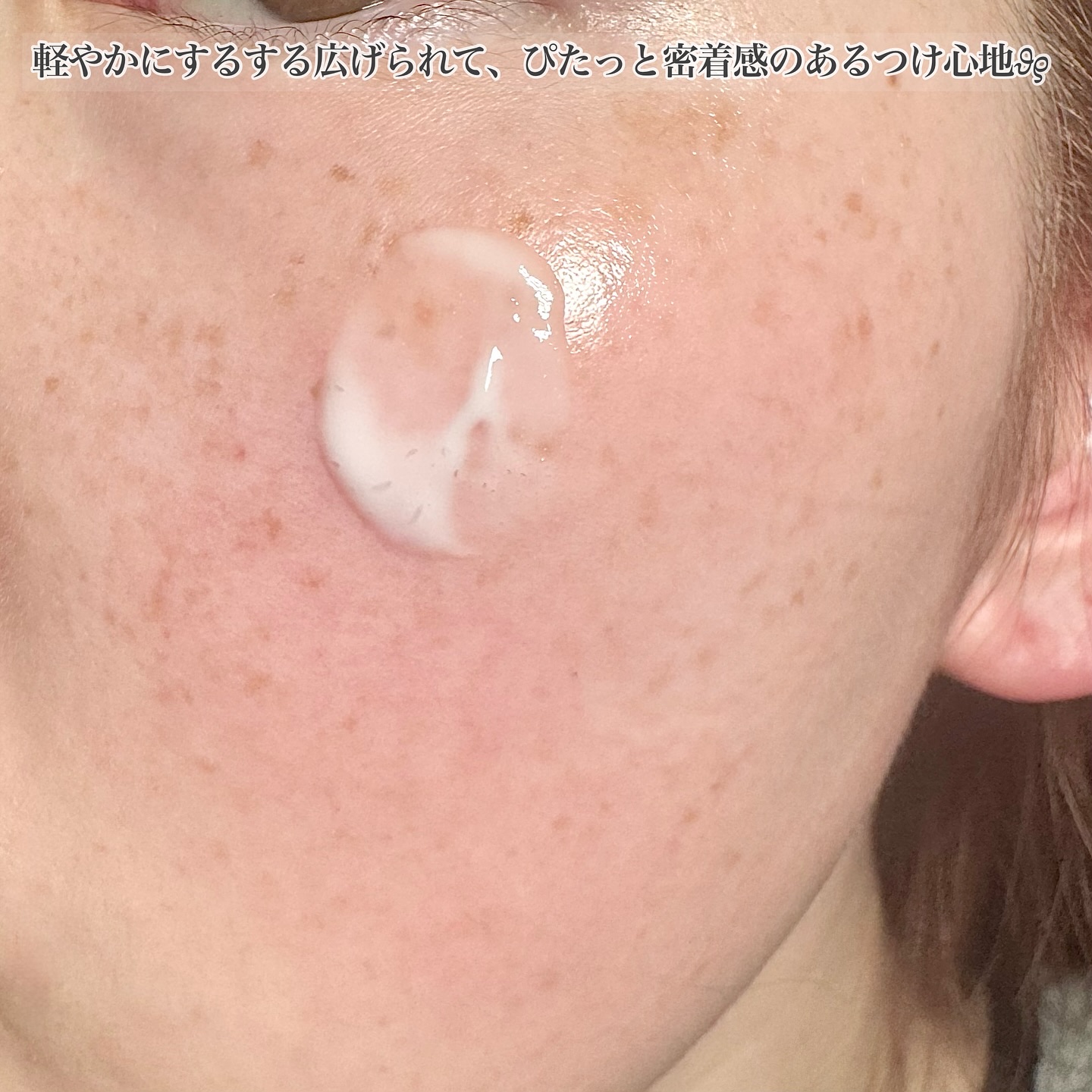 ニードルセラムＡＸ４/fractionalCC/美容液を使ったクチコミ（3枚目）