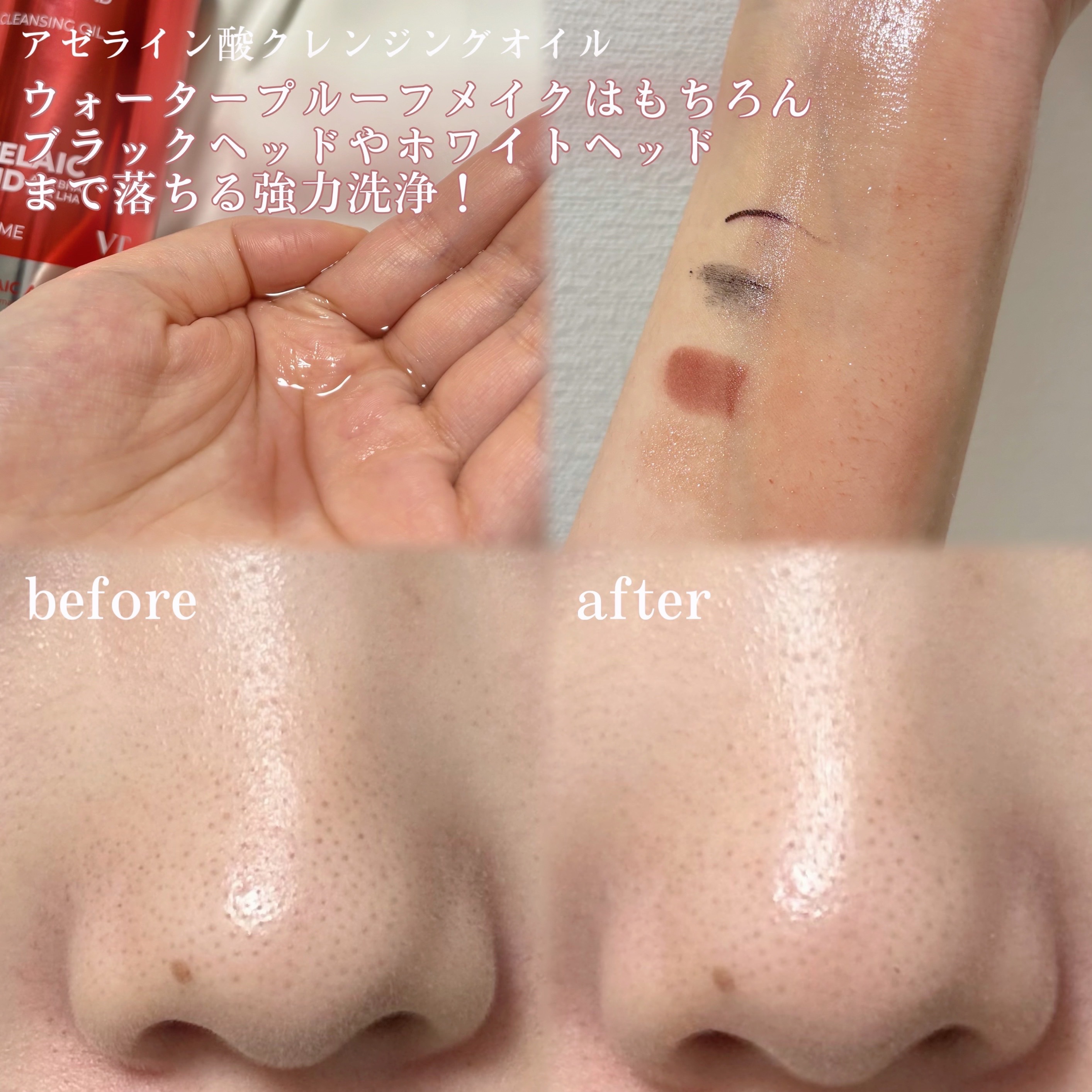 AZケア クレンジングオイル/VT/オイルクレンジングを使ったクチコミ（2枚目）