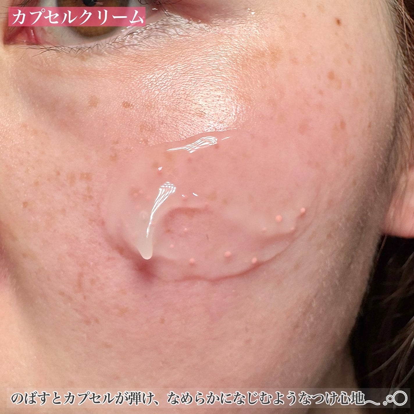 PDRNショット 1000+/fractionalCC/美容液を使ったクチコミ(6枚目)