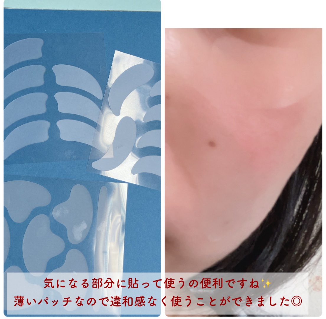 リンクルマスターパッチ/MADFORCOS/シートマスク・パックを使ったクチコミ（3枚目）