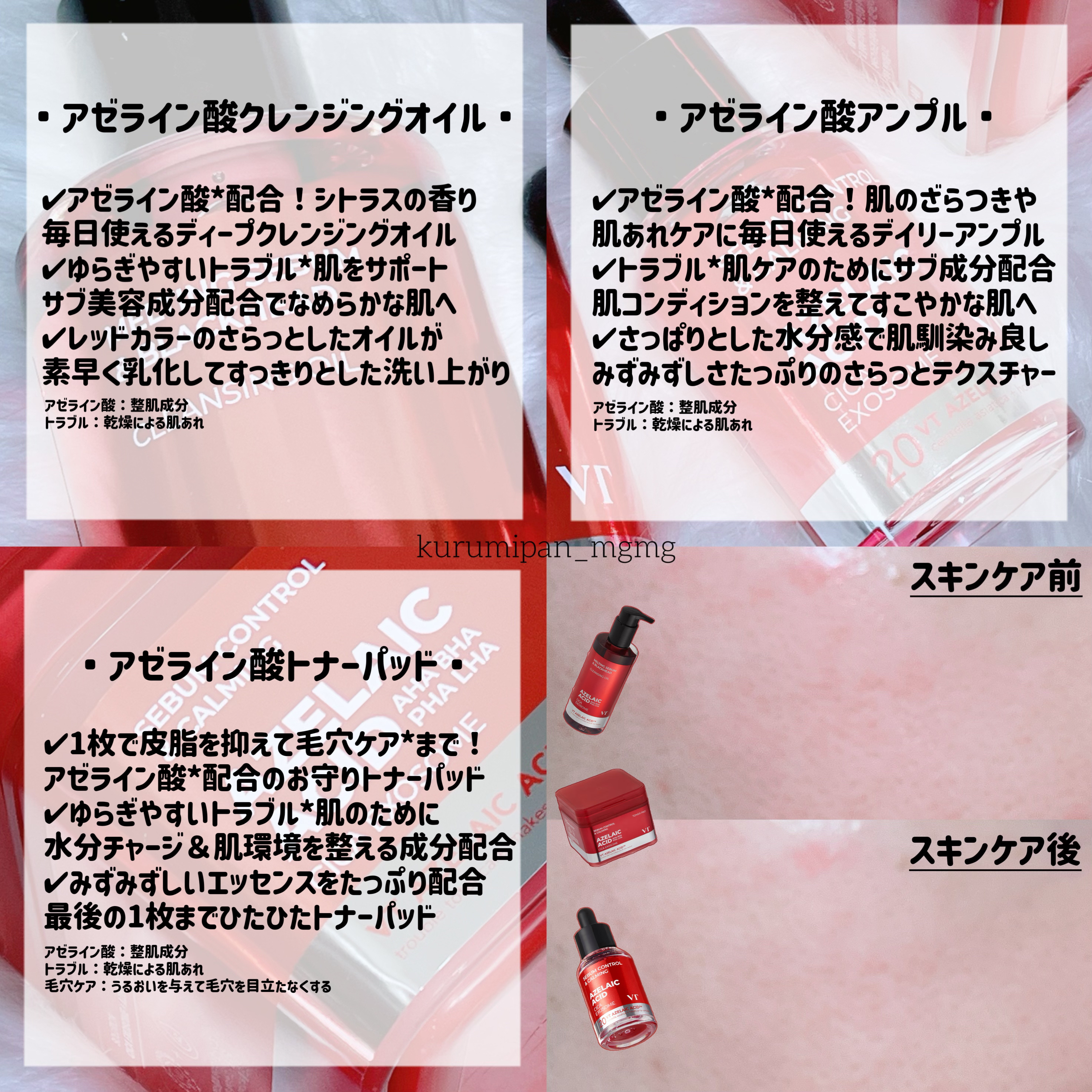 A1カーミング アンプル/VT/美容液を使ったクチコミ（2枚目）