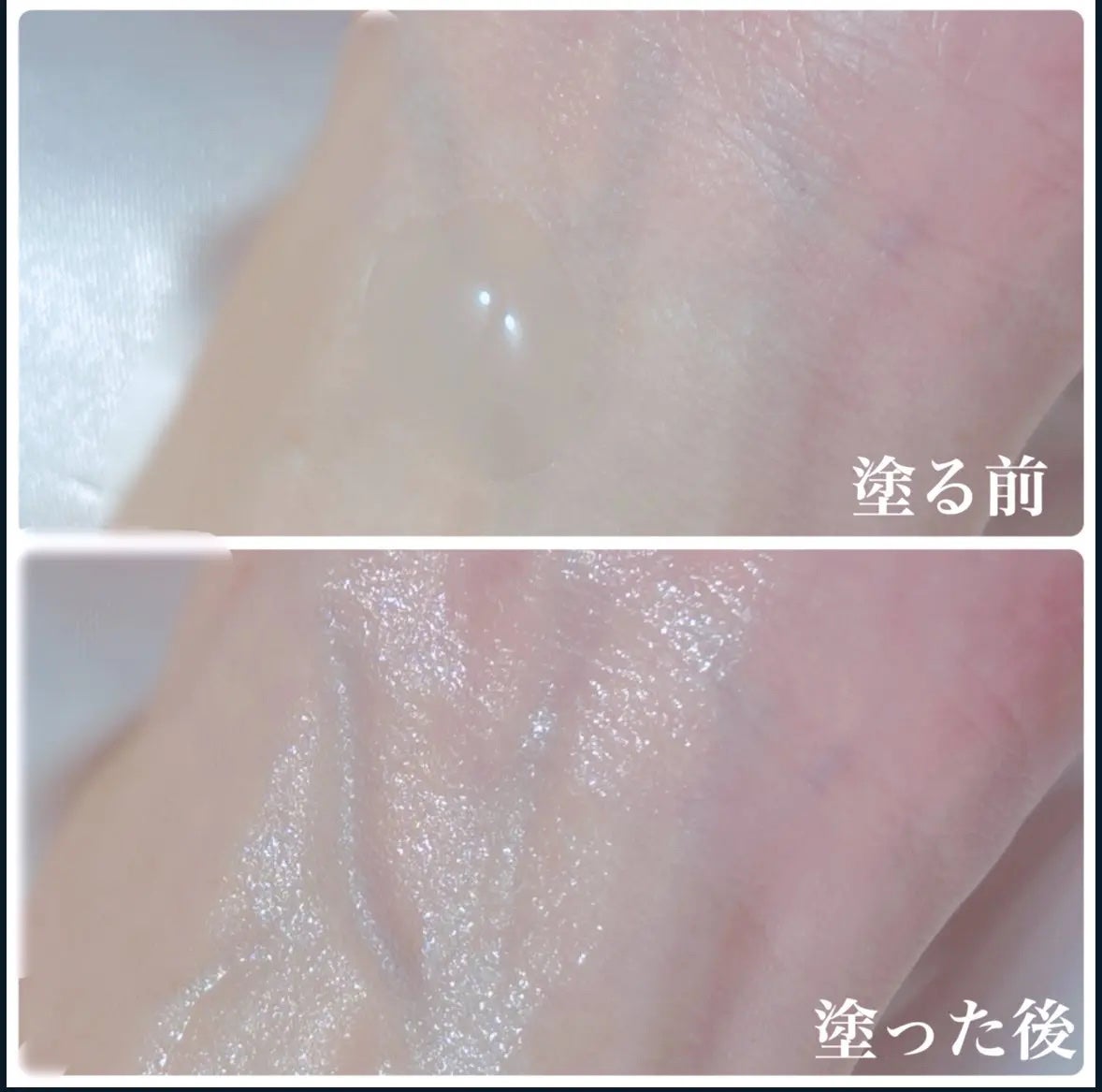 アルティミューン™ パワライジング セラム/SHISEIDO/美容液を使ったクチコミ(2枚目)