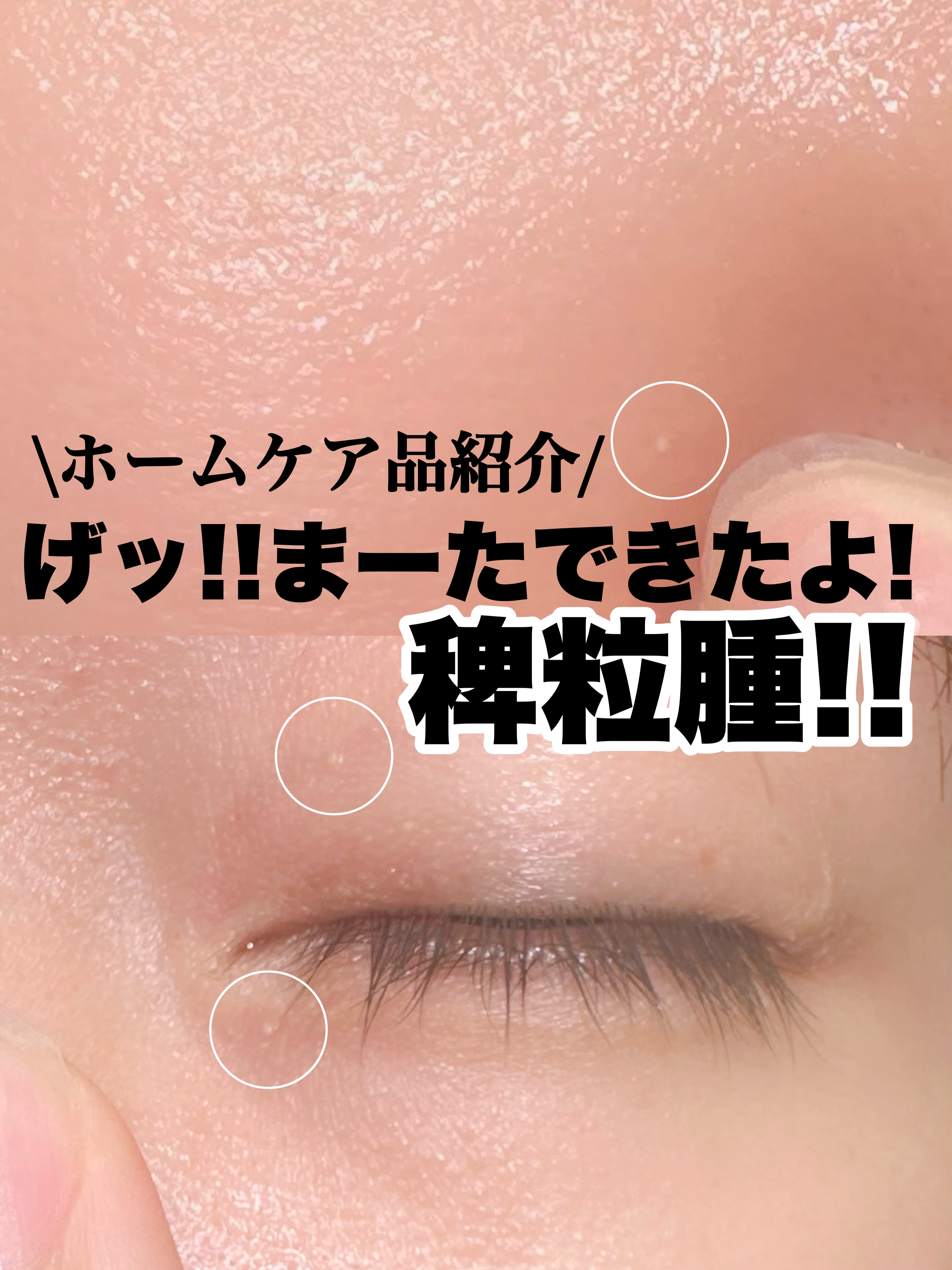 イポケアEX ジェルパッチ/ブレーンコスモス/その他スキンケアを使ったクチコミ（1枚目）