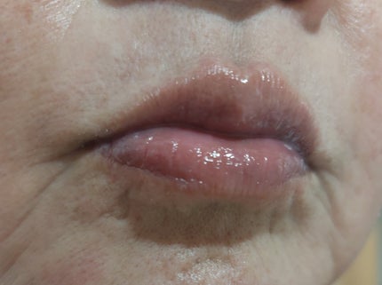 デイニードルリップ/CHOOSY/リップ美容液を使ったクチコミ(4枚目)