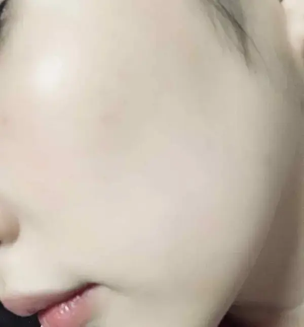 頬のアップ