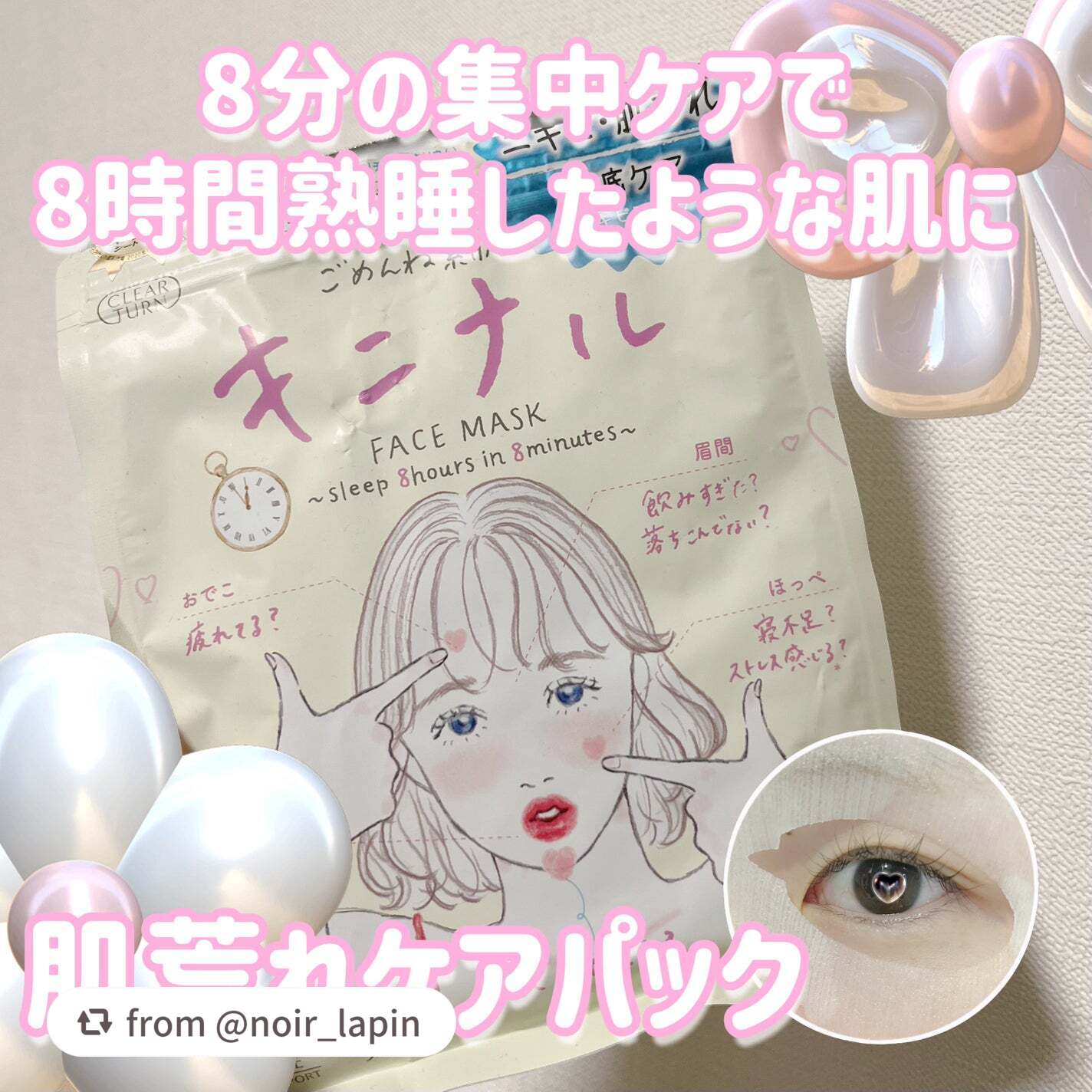 ごめんね素肌 キニナルマスク/クリアターン/シートマスク・パックを使ったクチコミ(1枚目)