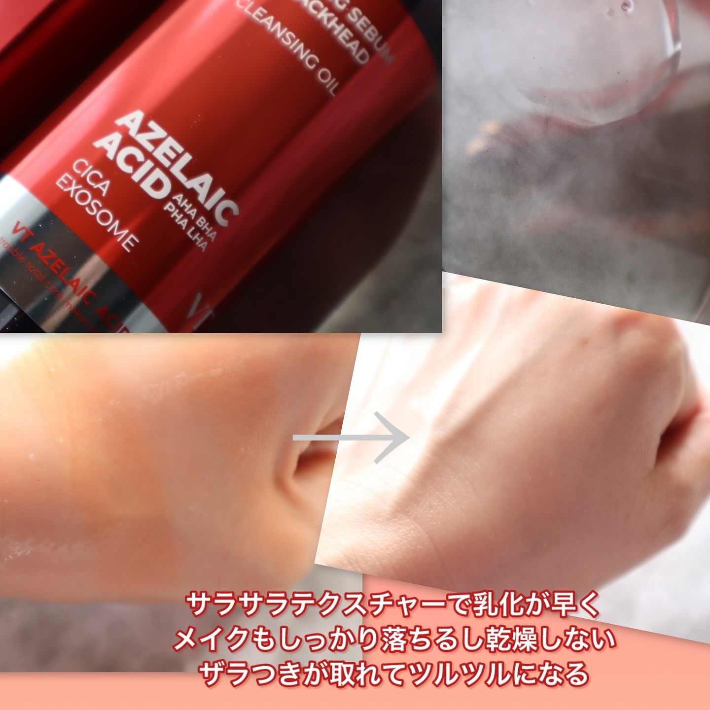 A1カーミング アンプル/VT/美容液を使ったクチコミ（2枚目）