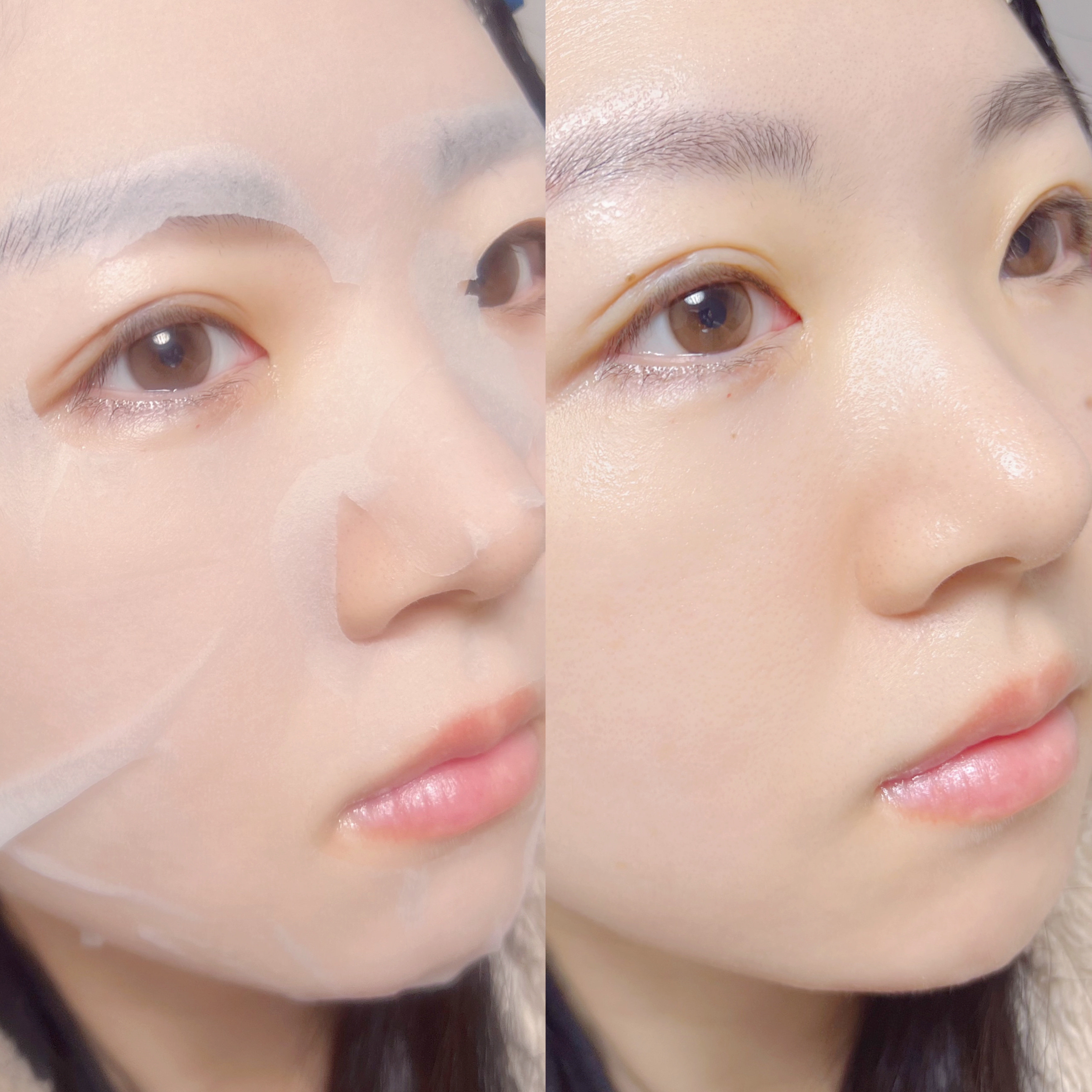 レッドブレミッシュクイックPHAシートマスク/Dr.G/シートマスク・パックを使ったクチコミ（2枚目）