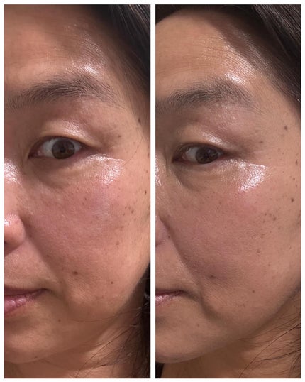 HARIAS 薬用クッションファンデーション/HARIAS/クッションファンデーションを使ったクチコミ(6枚目)