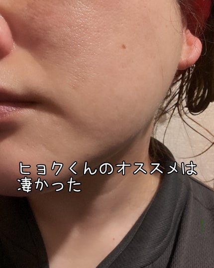 クラウドアンプル 1week キット/CHARDE/美容液を使ったクチコミ(5枚目)