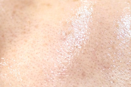 レッドモチセラム30/アレンシア/美容液を使ったクチコミ(5枚目)