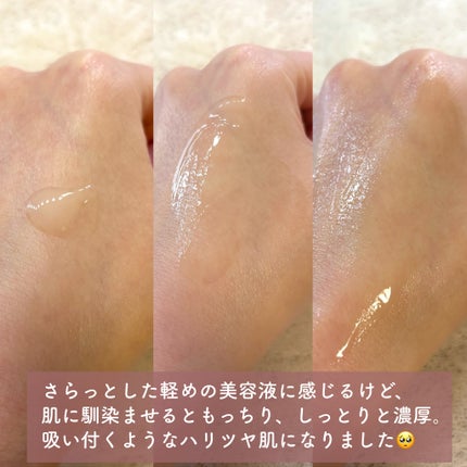 アルティミューン™ パワライジング セラム/SHISEIDO/美容液を使ったクチコミ(3枚目)