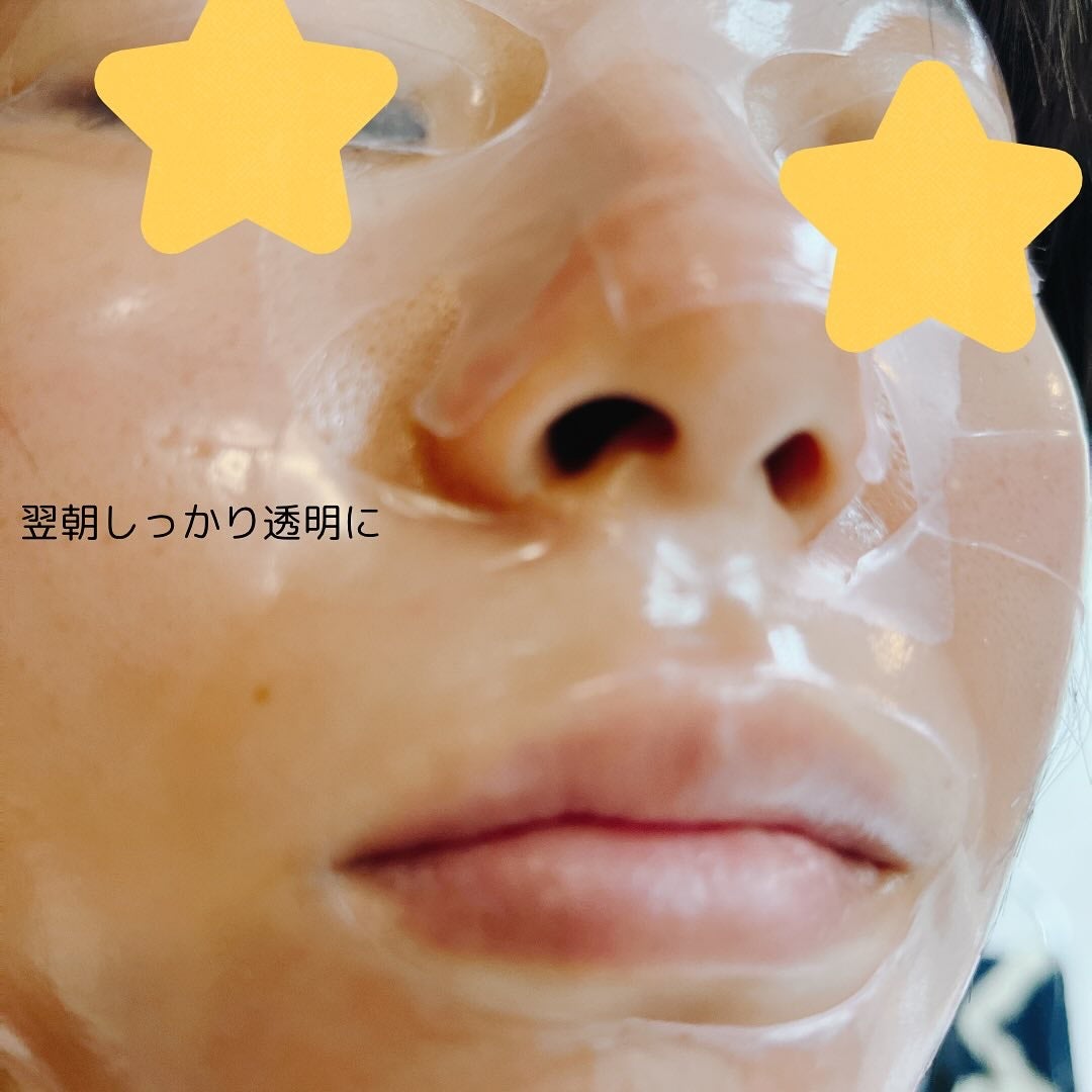 コラーゲンバウンスアップハイパーアクティブゲルマスク/SNP/シートマスク・パックを使ったクチコミ(5枚目)