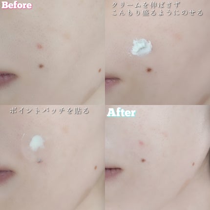 アクネスラボ 相澤メソッド 薬用ミドリクリーム/HIN アクネスラボ/フェイスクリームを使ったクチコミ(8枚目)