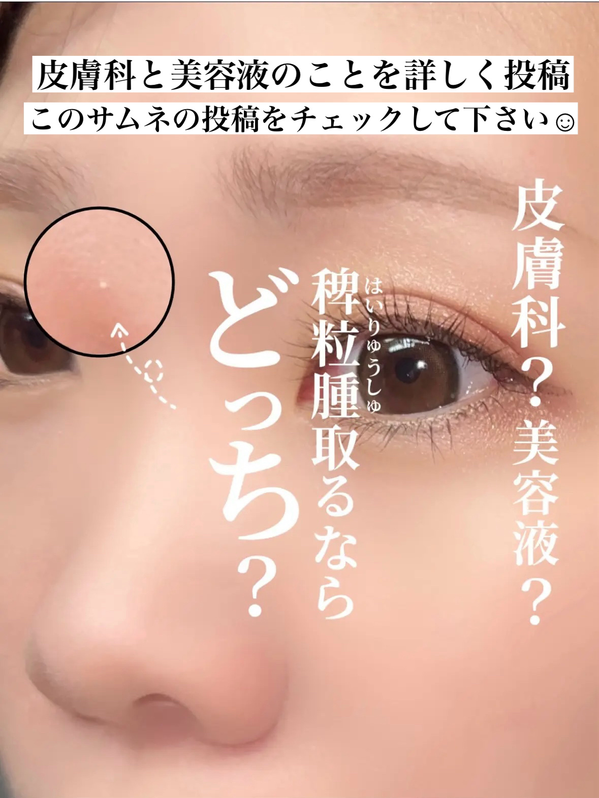 イポケアEX ジェルパッチ/ブレーンコスモス/その他スキンケアを使ったクチコミ（3枚目）