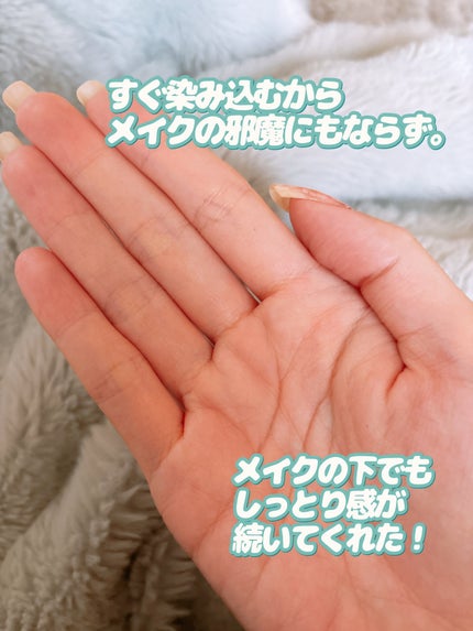 VC100エッセンスローション EX/ドクターシーラボⓇ/化粧水を使ったクチコミ(8枚目)