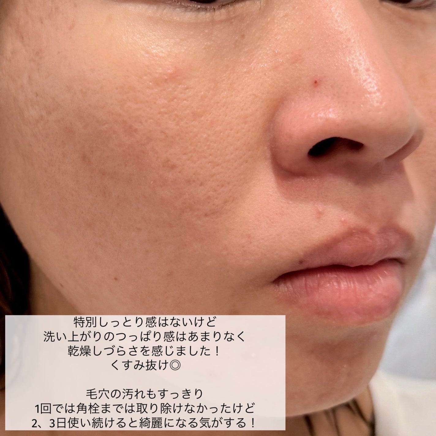 ピュアクレンジング クリア ピュアリバイブ/SINN PURETÉ/クレンジングジェルを使ったクチコミ(6枚目)