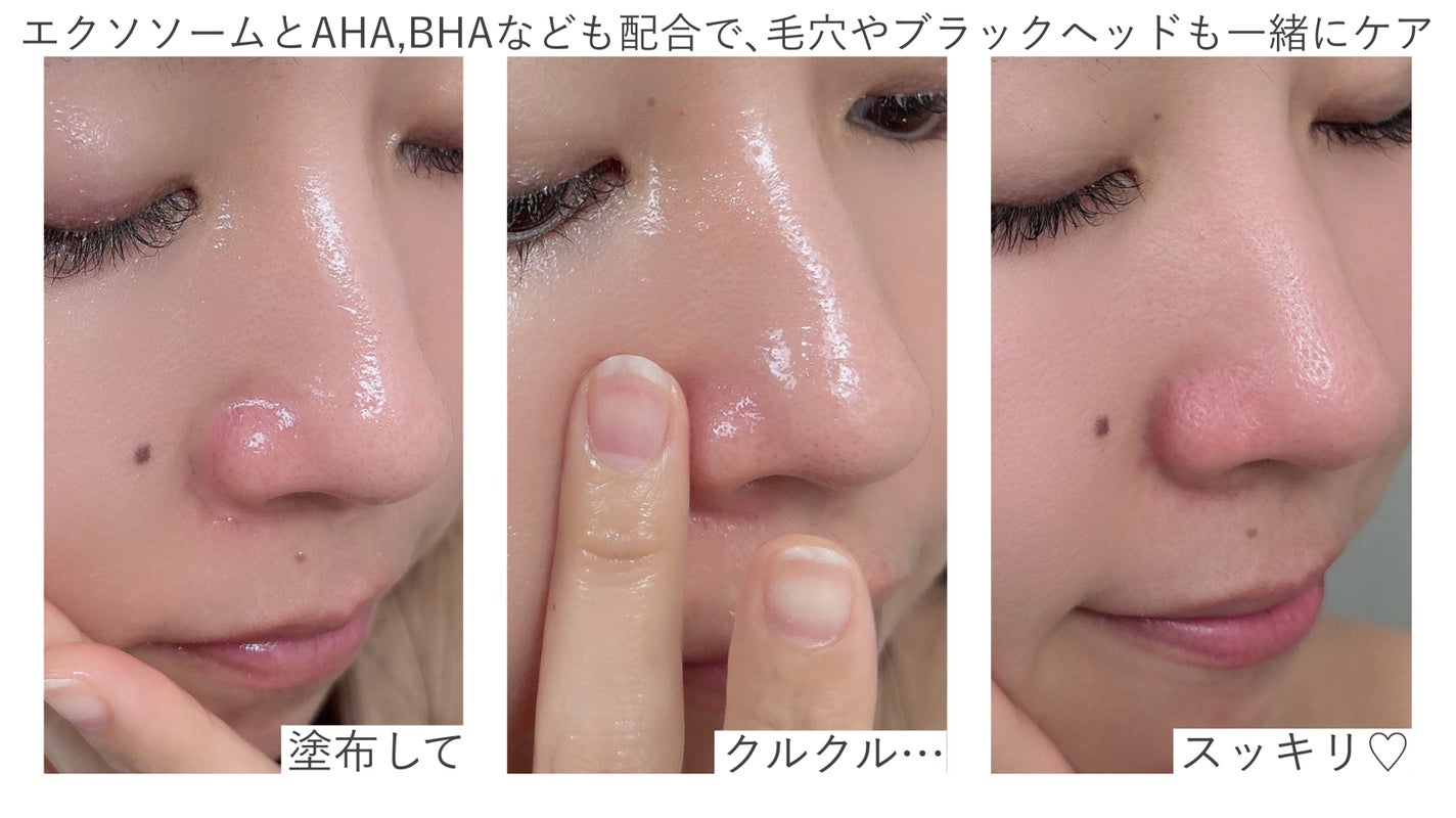 レッドブースター リードルショット100/VT/ブースター・導入液を使ったクチコミ(3枚目)