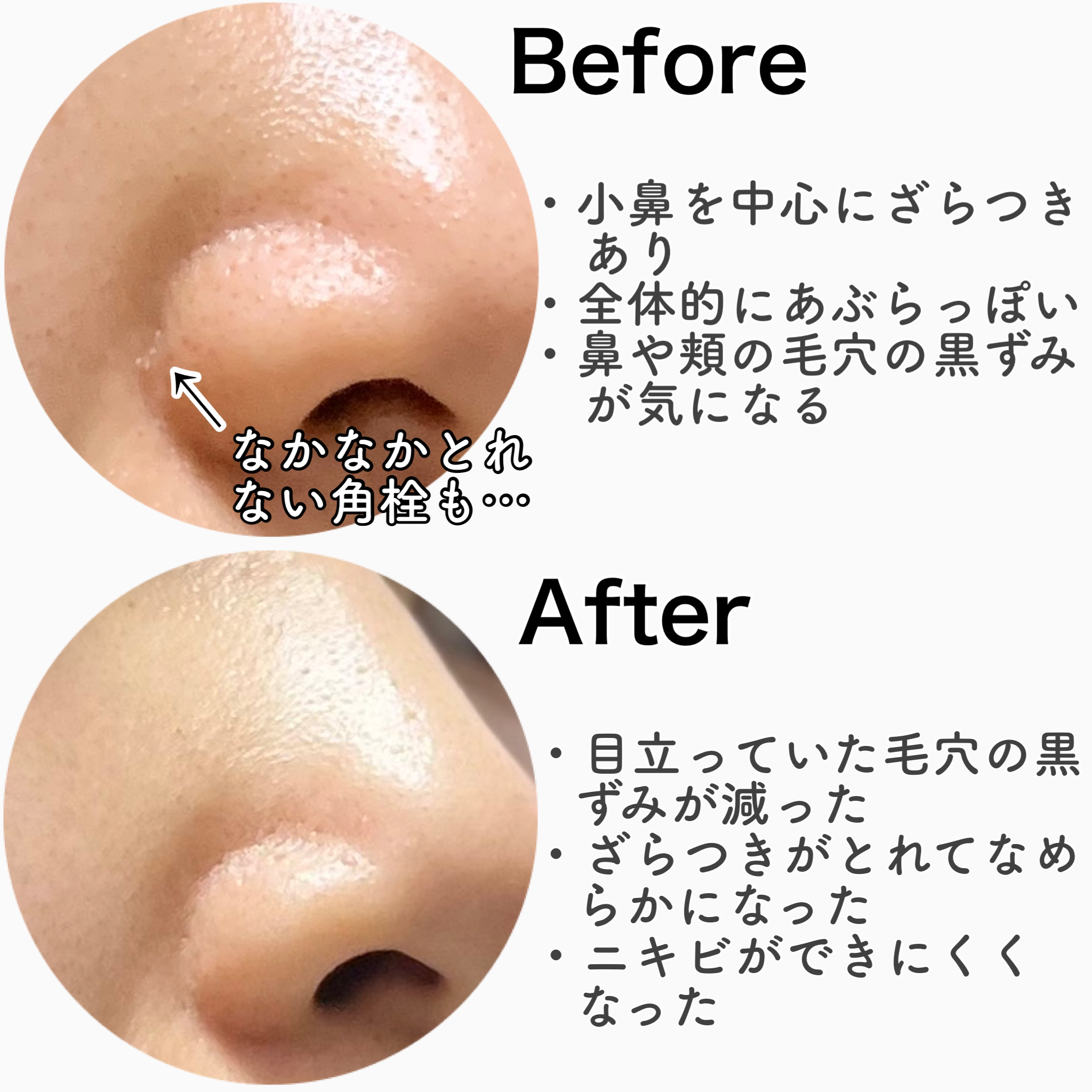 A1カーミング アンプル/VT/美容液を使ったクチコミ（2枚目）