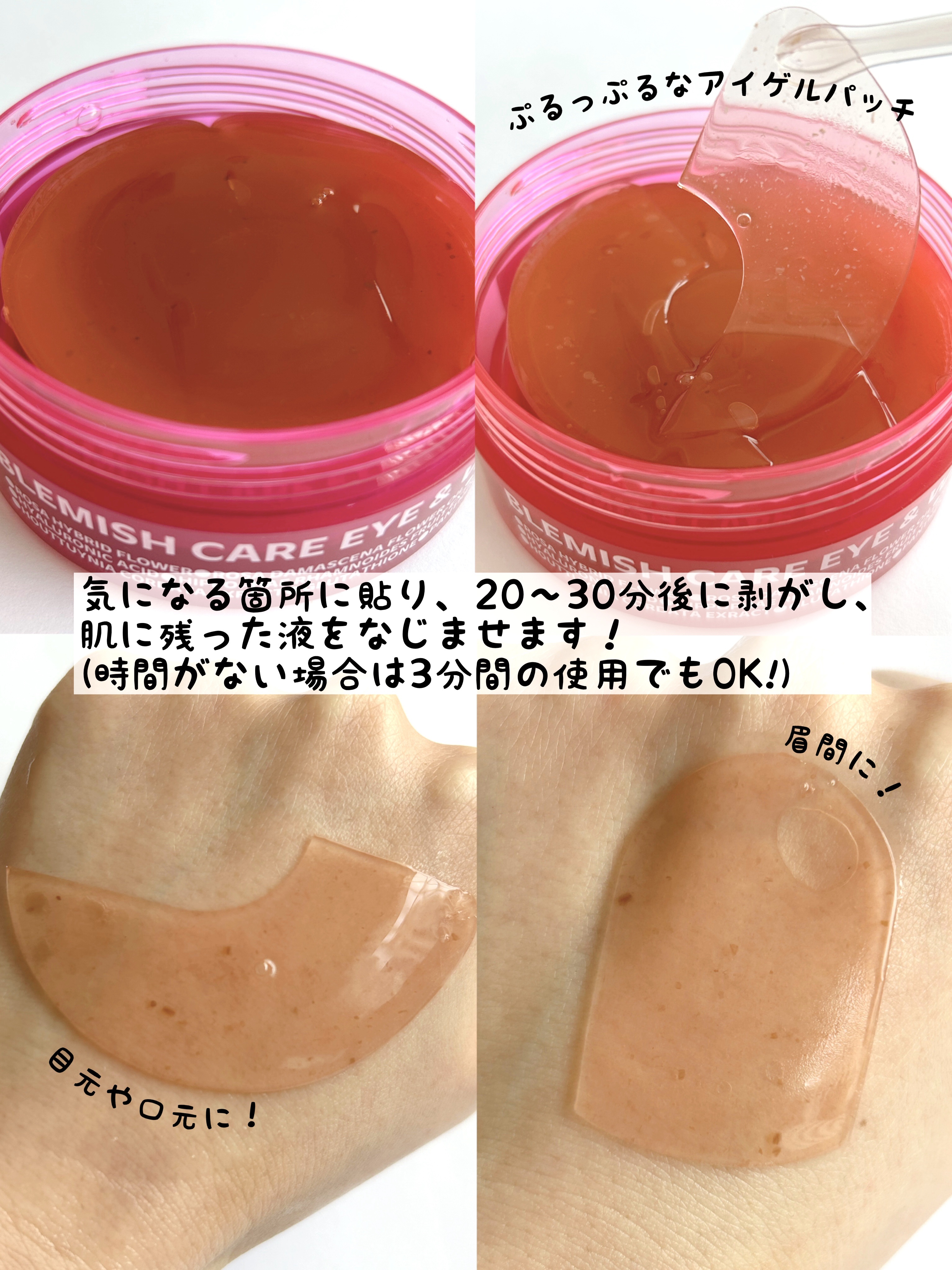 ブレミッシュケアアップ セラム/ISOI/美容液を使ったクチコミ（2枚目）