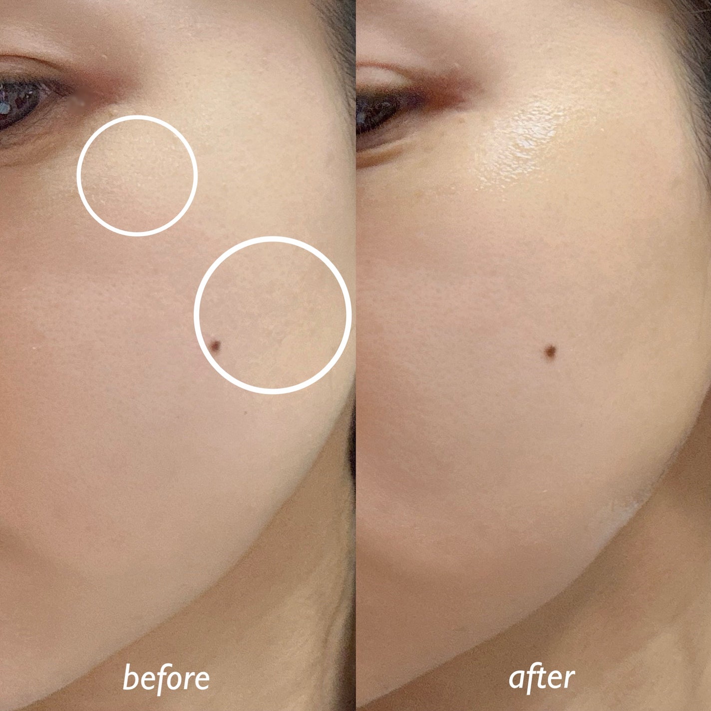 レッドブレミッシュ クリアスージングクリーム/Dr.G/フェイスクリームを使ったクチコミ(3枚目)