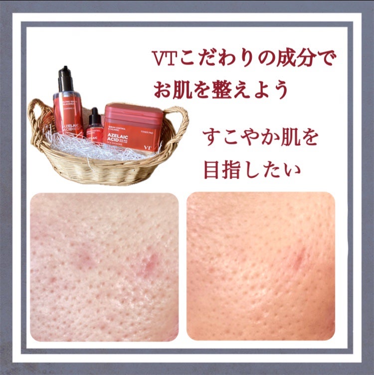 A1カーミング アンプル/VT/美容液を使ったクチコミ(2枚目)