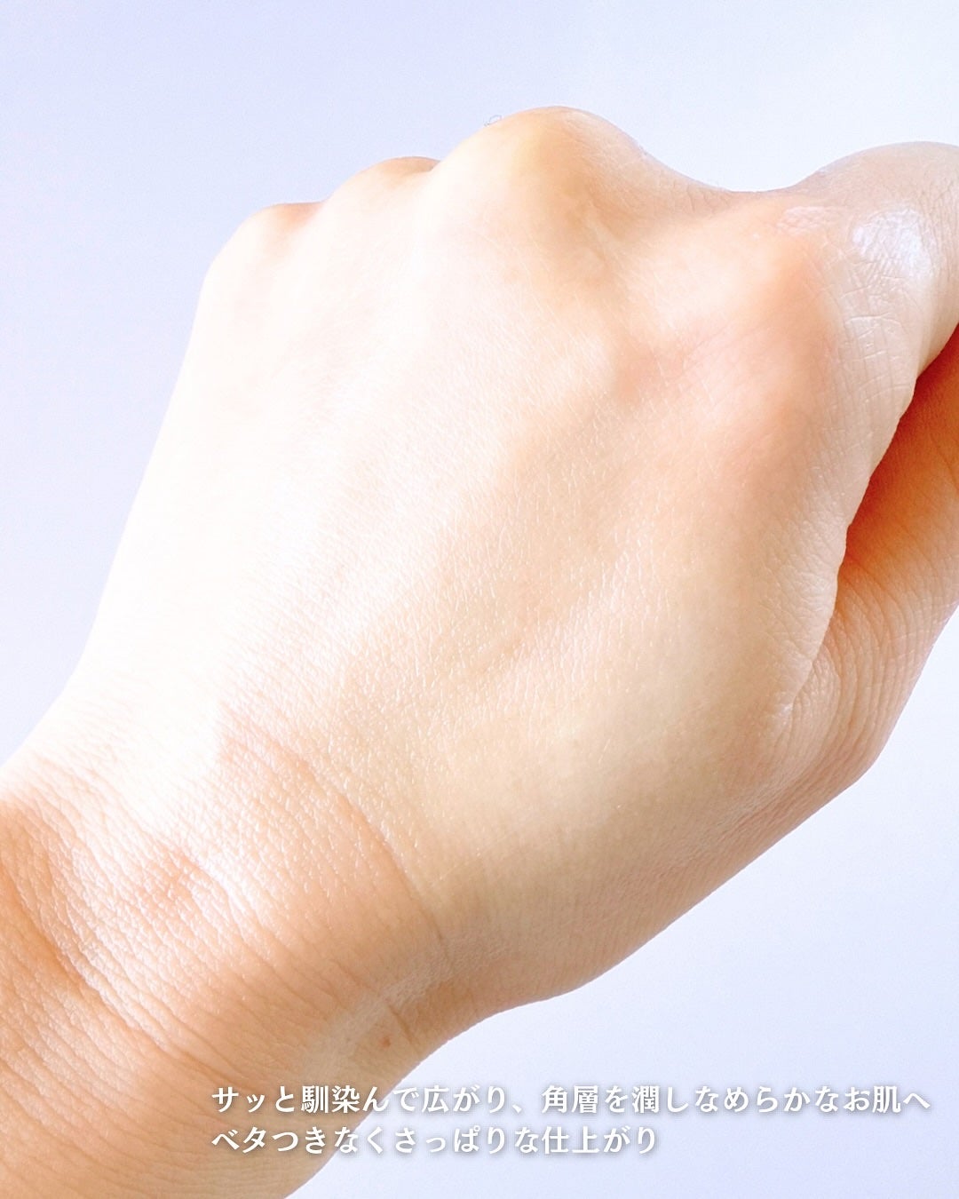 フレッシュモイスチャーボディローション/Derma:B/ボディローションを使ったクチコミ(5枚目)