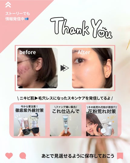 キャロットカロテン カーミングウォーターパッド/SKINFOOD/トナーパッドを使ったクチコミ(10枚目)