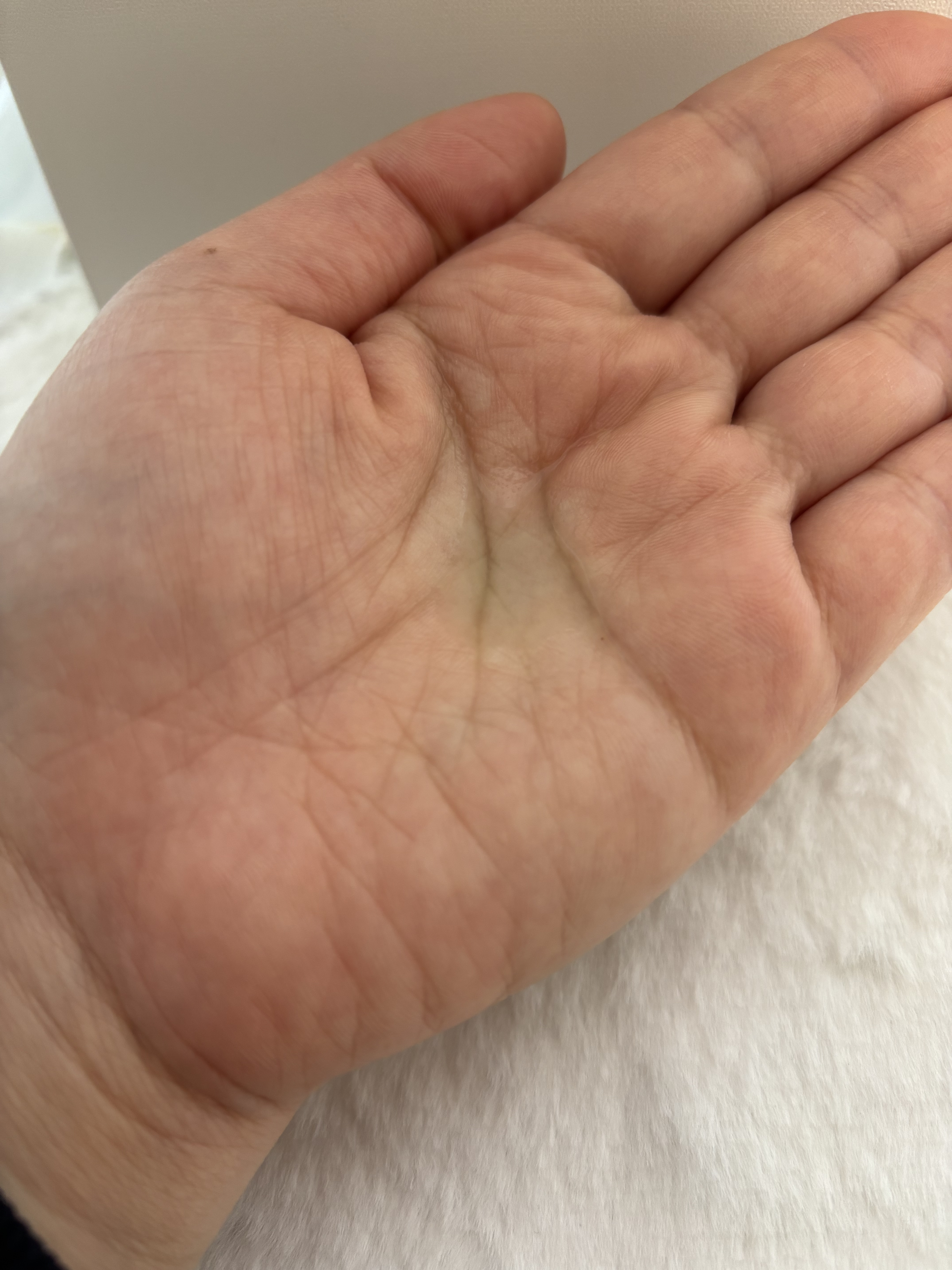 PDRNヒアルロン酸カプセル100セラム/Anua/美容液を使ったクチコミ（2枚目）