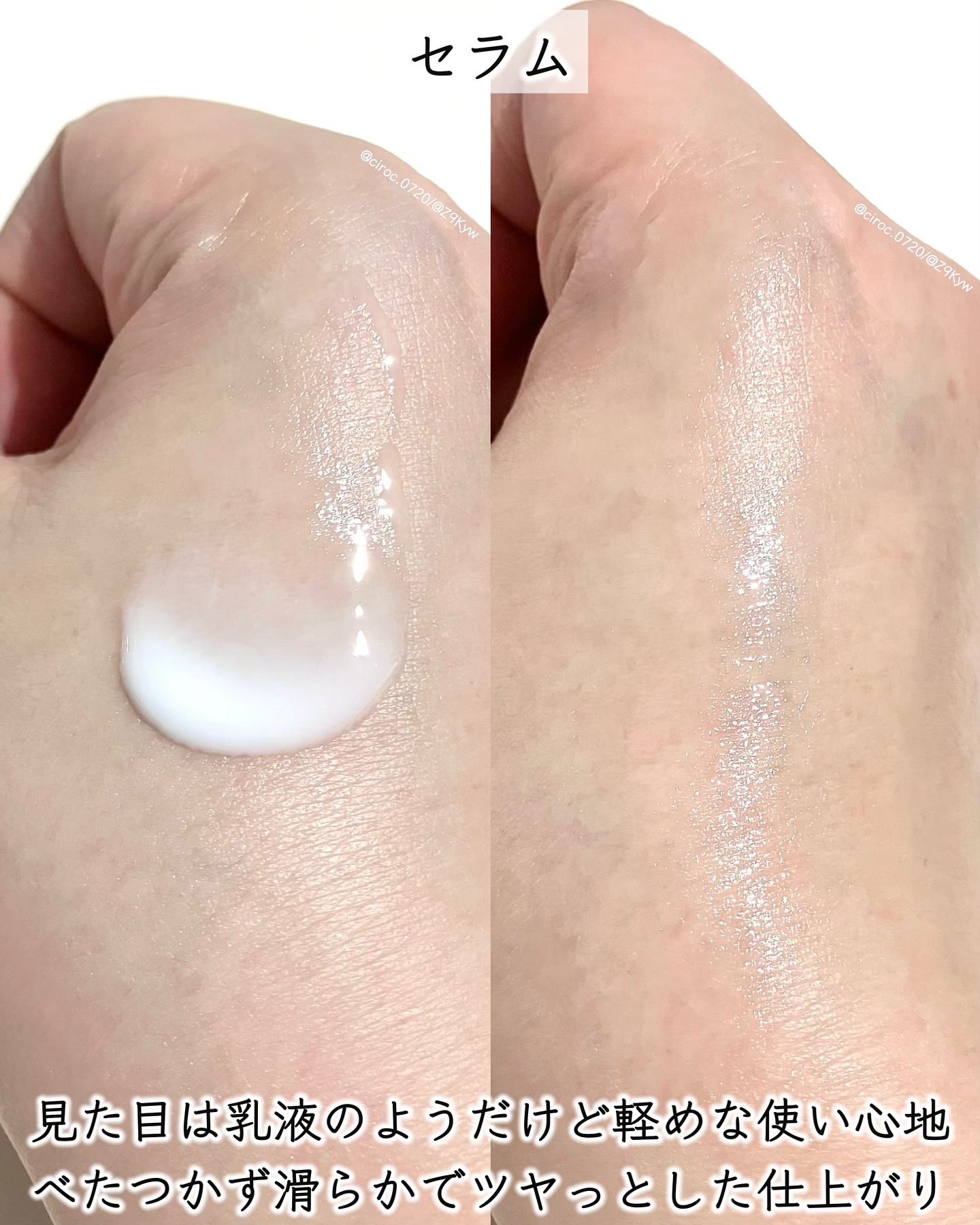 リードルショット100/VT/美容液を使ったクチコミ（3枚目）