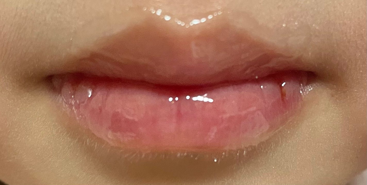 デイニードルリップ/CHOOSY/リップ美容液を使ったクチコミ(3枚目)