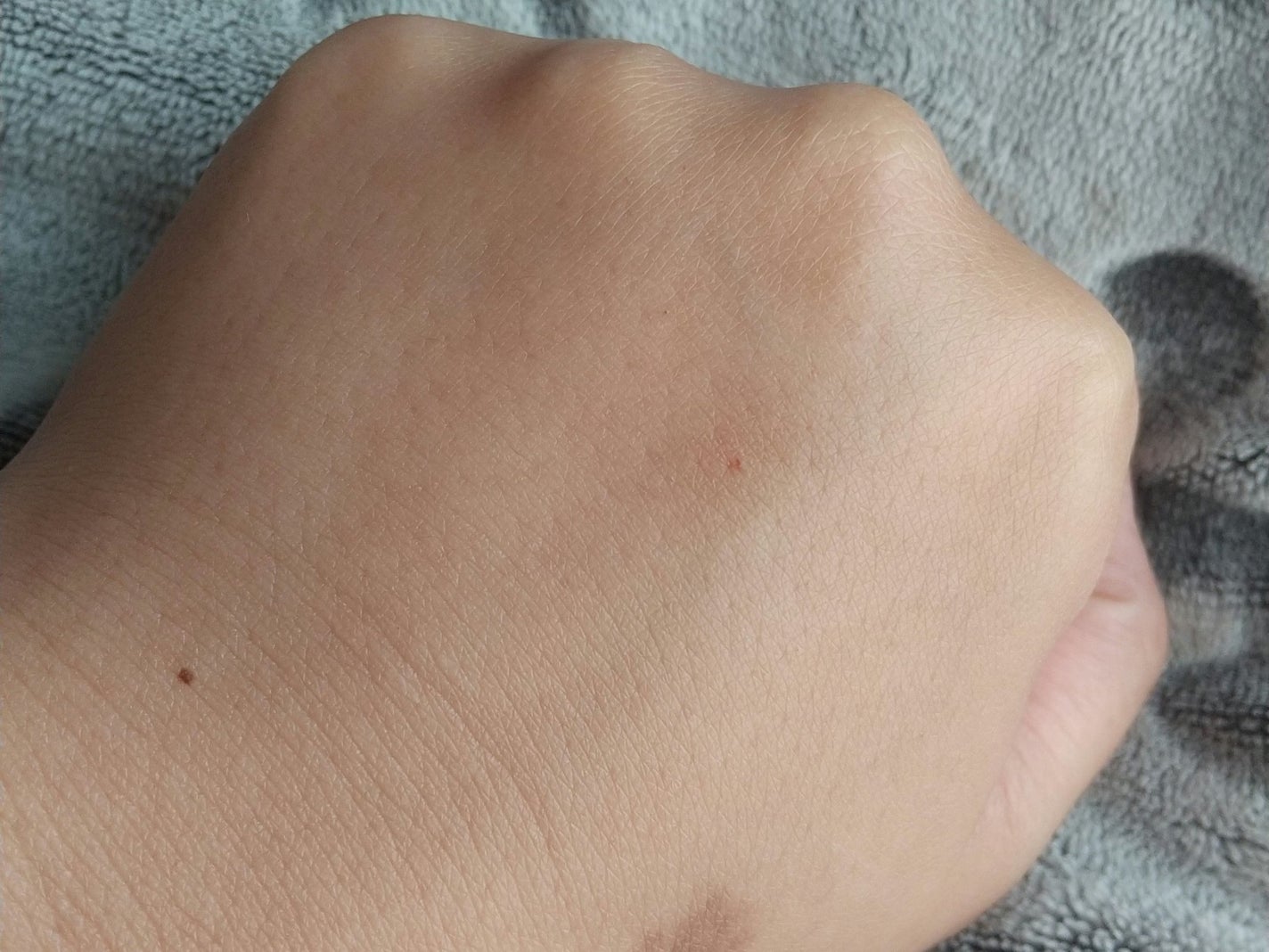 ブレミッシュケアアップ セラム/ISOI/美容液を使ったクチコミ(8枚目)