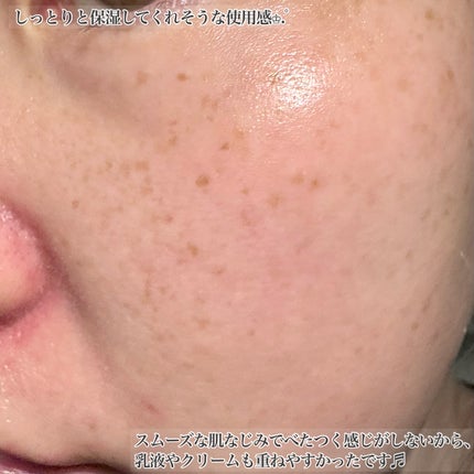 いち on LIPS 「*I'mfromリコリススージングアンプル30ml*天草エクソ..」(5枚目)