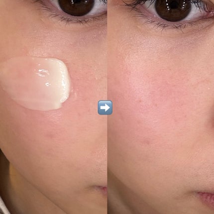 レッドブレミッシュ リペアスージングクリーム/Dr.G/フェイスクリームを使ったクチコミ(4枚目)