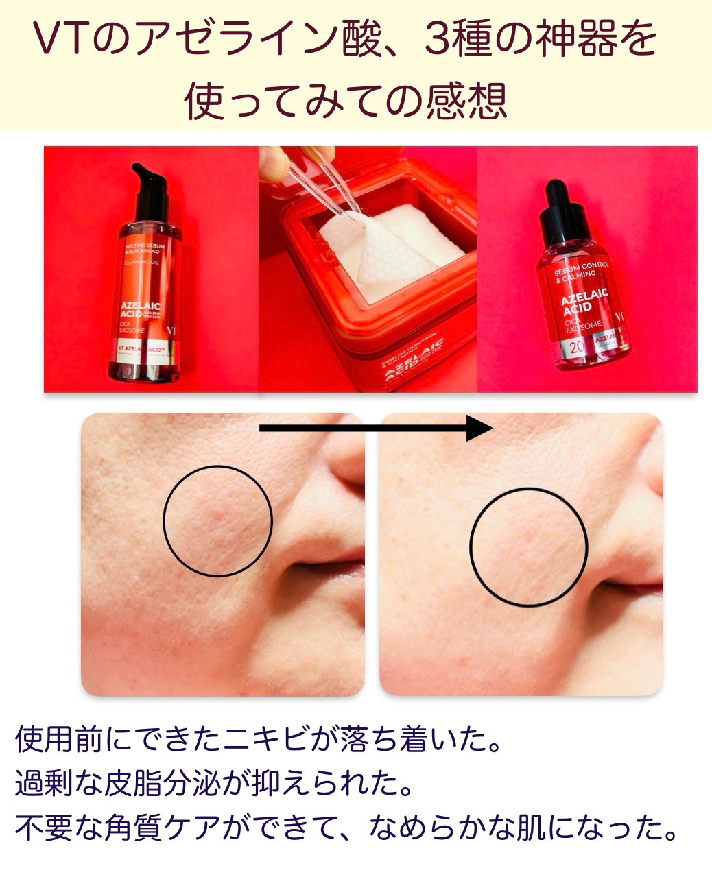 A1カーミング アンプル/VT/美容液を使ったクチコミ（3枚目）