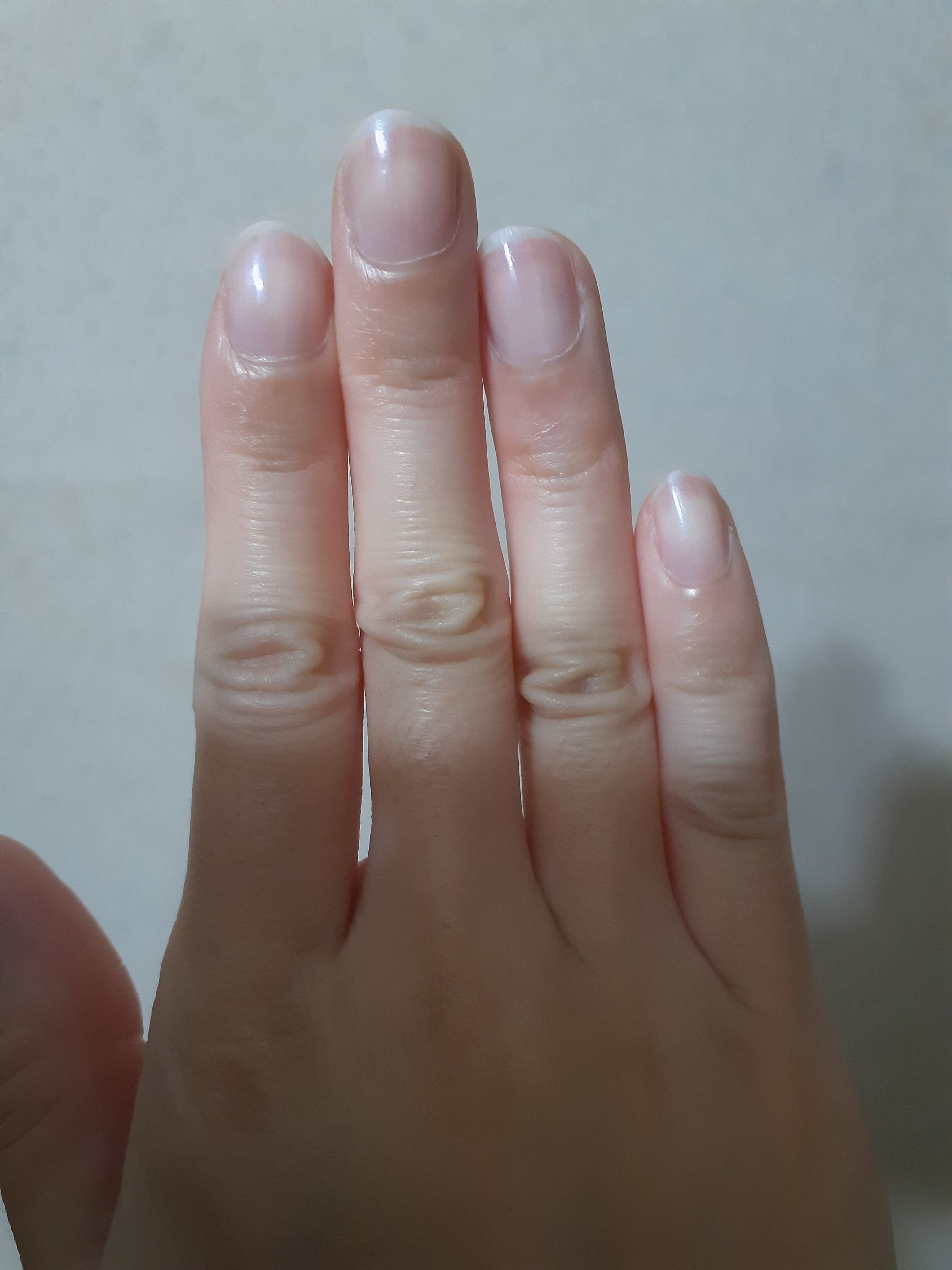 セリア ACサロンネイルプライマーのクチコミ「はじめに
お目汚し画像ございます。
苦手な方は閲覧ご遠慮くださいませ。

セリア　ACサロンネ.....」（2枚目）