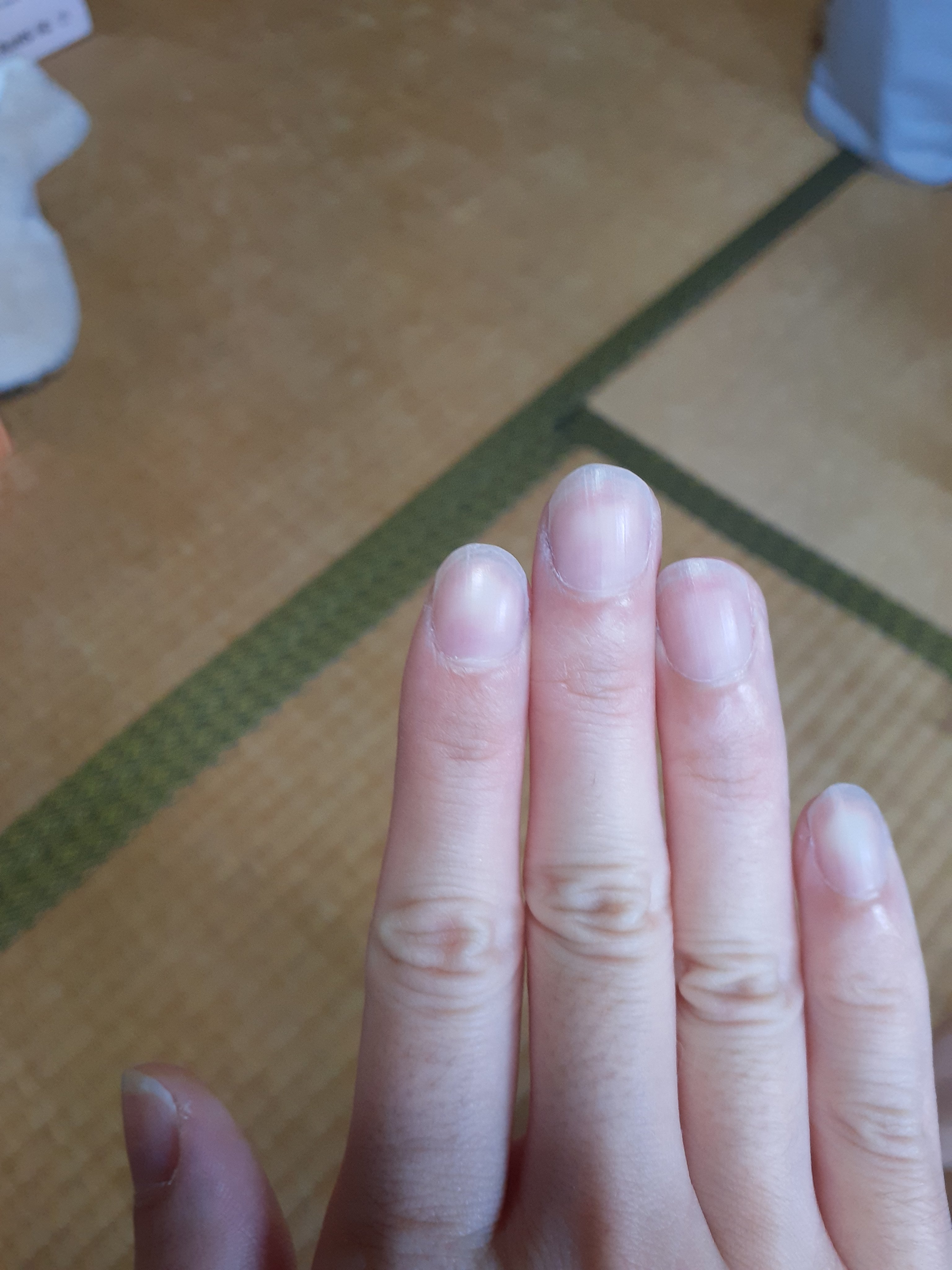 セリア ACサロンネイルプライマーのクチコミ「はじめに
お目汚し画像ございます。
苦手な方は閲覧ご遠慮くださいませ。

セリア　ACサロンネ.....」（3枚目）