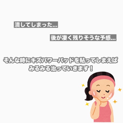 キズパワーパッド プラス/バンドエイド/その他を使ったクチコミ(2枚目)