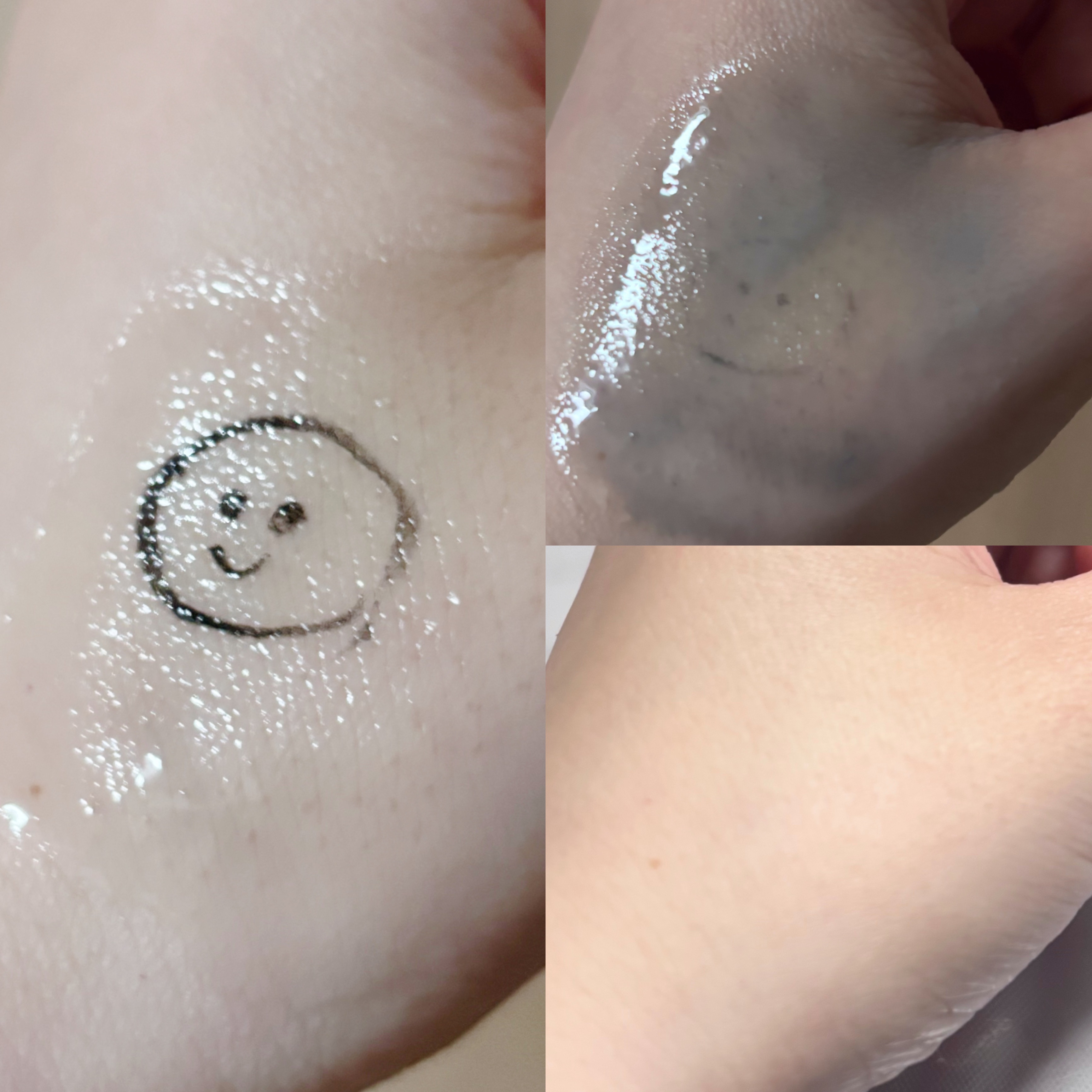 A1カーミング アンプル/VT/美容液を使ったクチコミ（3枚目）