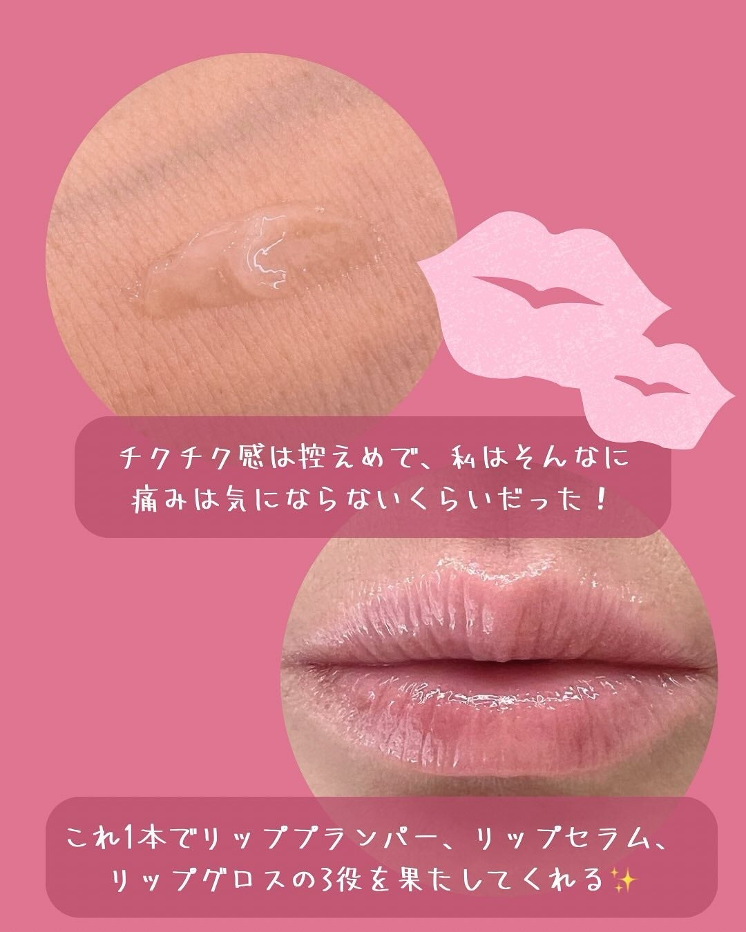 デイニードルリップ/CHOOSY/リップ美容液を使ったクチコミ(4枚目)