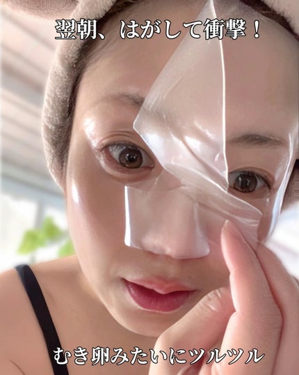 ✽ 佳 ✽スキンケア㋔㋟㋗ on LIPS 「𓂃𓈒𓏸衝撃🥚たまご肌韓国美女のつるつるなたまご肌の秘密💗現在ま..」(5枚目)